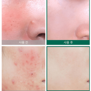 Крем AHA-BHA-PHA 30 Days Miracle Some By Mi