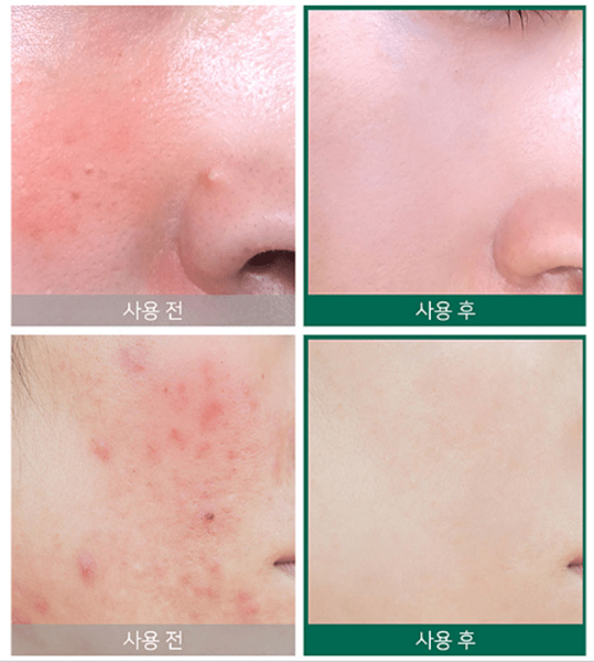 Крем AHA-BHA-PHA 30 Days Miracle Some By Mi